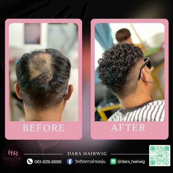วิกผมผู้ชายติดกาว