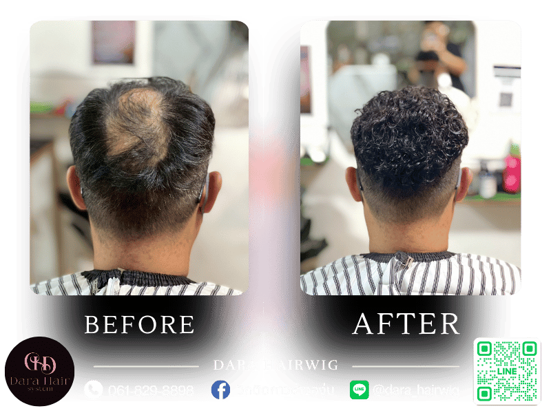 รับทำวิกผมแท้ผู้ชาย ติดกาว