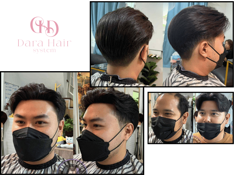 บริการติดผมแท้ เพื่อแก้ไขสภาพศีรษะ